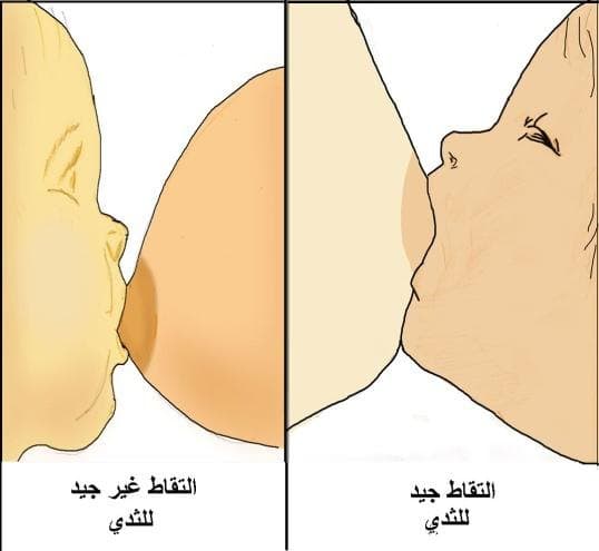 مقارنة بين التقاط سطحي للحلمة يسارًا والتقاط أعمق للثدي يمينًا